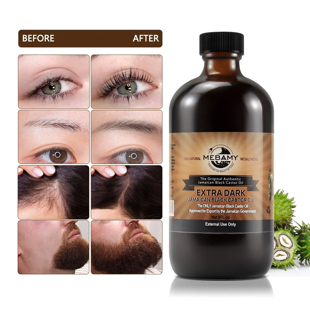 Private Label Natrual Organic Black Castor Oil cuidados com a pele cabelo Rosemary Mint Hair Strengthening Oil melhores produtos de crescimento do cabelo