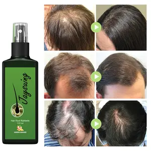 Wholesale Hair Growth Spray For Men And Women Treatment Of Hair Loss Ginger Oil Anti Hair Lotion