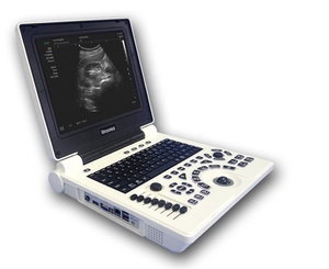 DMU03 Ecógrafo Médico Portátil de 12.1 Pulgadas, <span class=keywords><strong>Precio</strong></span> Económico, Imágenes Nítidas para Obstetricia y Ginecología - Product Image 4