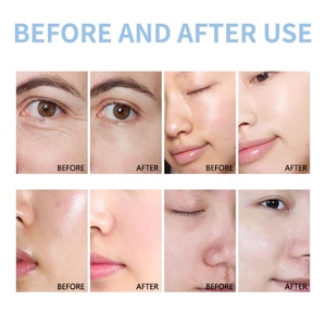Equipo de Hidrofacial con Oxígeno para Rejuvenecimiento de la Piel, Hidratación Profunda y Limpieza Facial, Gran Venta 2025 - Product Image 5