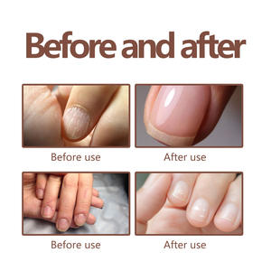 Aceite hidratante para uñas, para el cuidado de las uñas juego profesional, diseño de bola de rodillo de masaje, aceite para cutículas de uñas - Product Image 3