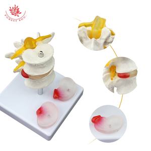 Modèle de lésion de la colonne vertébrale lombaire FRT038 modèle de pathologie vertébrale à deux segments du disque lombaire enseignement des étudiants en médecine - Product Image 5