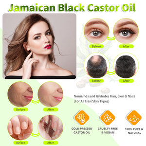 Jamaican naturale organico <span class=keywords><strong>olio</strong></span> di ricino a base di erbe nutriente essenziale per la cura dei <span class=keywords><strong>capelli</strong></span> secchi <span class=keywords><strong>idratante</strong></span> trattamento liscio <span class=keywords><strong>olio</strong></span> di ricino nero - Product Image 3