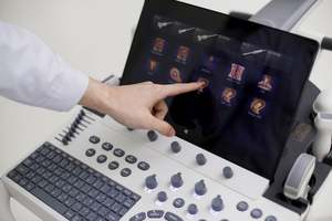 Sonosape P50Elite mesin <span class=keywords><strong>Ultrasound</strong></span>, resolusi tinggi <span class=keywords><strong>3D</strong></span>/<span class=keywords><strong>4D</strong></span> Doppler warna dengan Diagnosis bantuan AI - Product Image 4