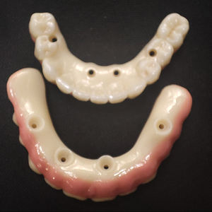 Prothèse dentaire implantable hybride avec fournitures en porcelaine pour les gencives, abutments personnalisés en zircone et titane pour les implants, tout sur 4 - Product Image 2