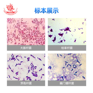 Cinq types de bactéries en forme de tiges provenant de l'école de médecine ont été clairement observés sous un microscope sur une lamelle de verre. - Product Image 4