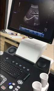 CE Hospital Clínica VET 3D Color Doppler Ultrasonido Máquina Veterinario Carretilla de ultrasonido de la máquina de ultrasonido de la JM-908A - Product Image 4