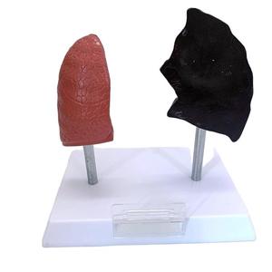 Modelo comparativo para pulmón <span class=keywords><strong>de</strong></span> <span class=keywords><strong>fumador</strong></span> vs equipo educativo <span class=keywords><strong>de</strong></span> pulmón normal - Product Image 3