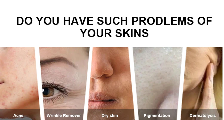 14 az 1-ben Hydrofacial Machine – Oxigén-víz dermabrázió, Hidratáló bőrtisztítás, Arcfiatalító Szépségfelszerelés