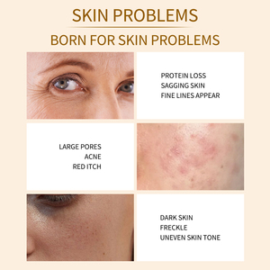 سيروم حمض الكوجيك والكركم والنياسيناميد من TWG RTS، 30 مل، مضاد لحب الشباب ومبيض للبشرة، مضاد للبقع الداكنة، سيروم للعناية بالبشرة بحمض الكوجيك - Product Image 6