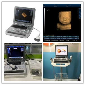 Ecógrafo Veterinario Portátil con Certificación CE, Económico, en Blanco y Negro, 3D, <span class=keywords><strong>Transvaginal</strong></span> - Product Image 4
