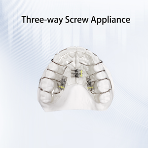Vis orthodontique à trois voies <span class=keywords><strong>pour</strong></span> <span class=keywords><strong>appareil</strong></span> <span class=keywords><strong>dentaire</strong></span>, destinée à l'expansion de la voie <span class=keywords><strong>dentaire</strong></span> étroite et à la distalisation des molaires en malocclusion de classe II - Product Image 3