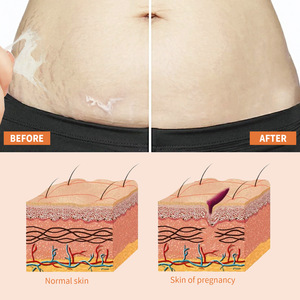 OUHOE Huile anti-vergetures et cicatrices de <span class=keywords><strong>grossesse</strong></span>, réparation et élimination des vergetures, soin apaisant, vente en gros - Product Image 3