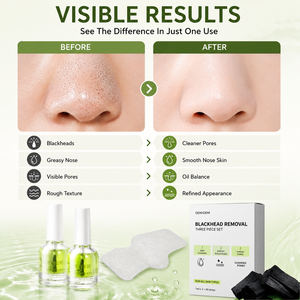 Masque nasal de luxe au collagène doré <span class=keywords><strong>pour</strong></span> le blanchiment, l'hydratation, la détoxification des <span class=keywords><strong>points</strong></span> <span class=keywords><strong>noirs</strong></span> et le soin raffinant des pores - Product Image 2