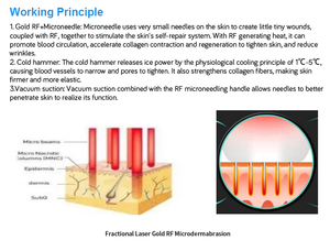 Máquina Facial 2 en 1 Multifuncional para el Cuidado de la Piel, Lifting de Ojos, Eliminación de Lunares, Radiofrecuencia Fraccionada, Microagujas de Oro - Product Image 5