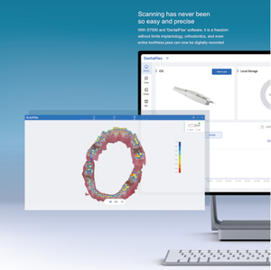 Scanner Intraorale Wireless 3D per Modelli Ortodontici e Riparazioni, Scansione Dentale 3D Senza Iniezione di Polvere - Product Image 5
