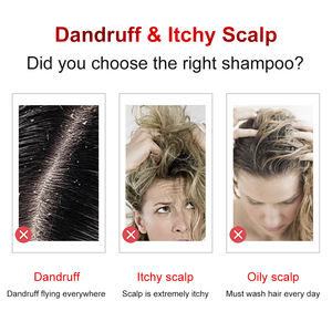 Großhandel Private Label Sulfatfreies Shampoo Natürliches Bio Haar Anti-Schuppen Feuchtigkeitsshampoo - Product Image 3