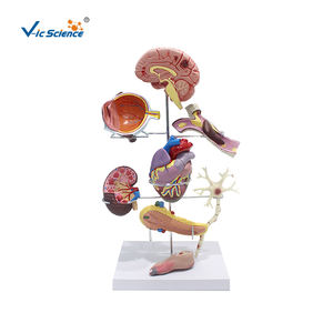 Modelo Anatómico de <span class=keywords><strong>Diabetes</strong></span> Tipo 2, Modelo de PVC para Ciencias Médicas, para Escuelas de Medicina y Hospitales - Product Image 1