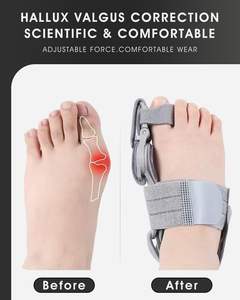 مصحح تشوه إصبع القدم الكبير، فاصل أصابع القدم قابل للتعديل، مضاد للانزلاق، مصنوع من النايلون، مناسب لجميع الأعمار، للقدم اليسرى/اليمنى، لتخفيف آلام التهاب المفاصل - Product Image 3