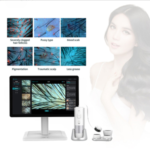 Analyseur de cuir chevelu professionnel à intelligence artificielle pour cheveux et peau, avec prise IT et analyse de l'acné pour la tête et la peau, usage commercial - Product Image 3