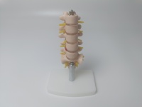 Modelo Anatómico Humano de Columna Vertebral con Vértebras Lumbares, Sacro y Coxis, y Hernia Discal, Tamaño Real, para Enseñanza Médica