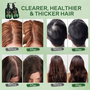Shampoo à l'huile de Batana naturelle et biologique OEM/ODM 500g, shampooing fortifiant pour <span class=keywords><strong>cheveux</strong></span>, anti-chute, réparation des <span class=keywords><strong>cheveux</strong></span> secs et crépus - Product Image 2