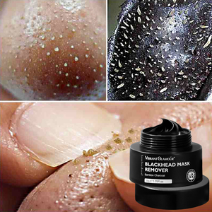 Vibrante Glamour 30g Gel con Aloe Vera poro Anti-invecchiamento macchie scure assorbono olio succhiatore punti neri e testa bianca - Product Image 5