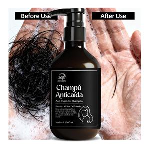 Champú <span class=keywords><strong>Anticaída</strong></span> Intenso al por Mayor de Fábrica con Extractos Herbales, Champú <span class=keywords><strong>Anticaída</strong></span> con Proteína de Trigo y Hierbas Asiáticas - Product Image 2