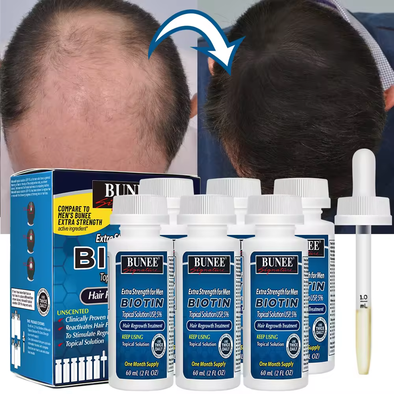 Popular 60ml 5 Kirland Hair Regrowth