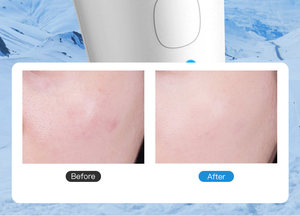 Gesichts massage gerät mit Heizungs kühlung zur Reduzierung glatter feiner Linien Haut verjüngung Anti-Falten-Fein linien gerät - Product Image 5