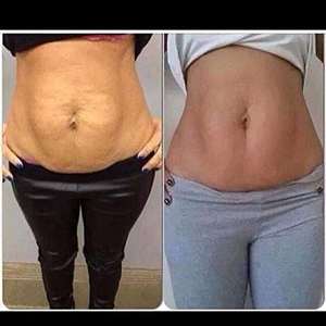 Su misura OEM/ODM Anti-Cellulite Gel dimagrante crema Private Label per la perdita di peso vegano con vitamina C rassodante ingredienti - Product Image 3