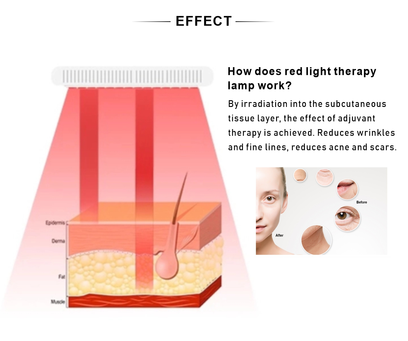 No Flicker 5W Red LED Light Therapy 300LEDs Near Infrared