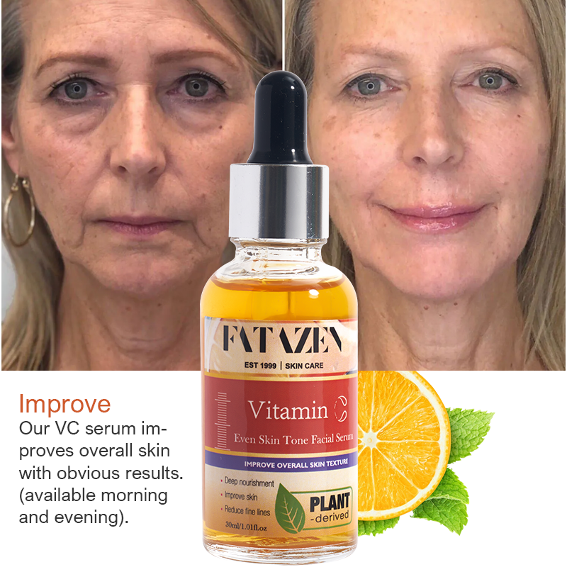 เหลือง / ทอง