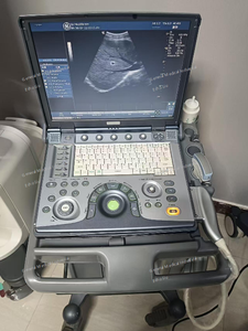 Ecógrafo Portátil GE LOGIQ E de <span class=keywords><strong>Segunda</strong></span> <span class=keywords><strong>Mano</strong></span>, Reacondicionado, con Sonda Convexa y Doppler Color para Hospital - Product Image 2