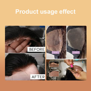 OALEN Hair Bonding Remover Oil 150ml avec huile d'olive Vitamine E Formule douce pour perruques Extensions de <span class=keywords><strong>cheveux</strong></span> - Product Image 6