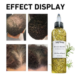 Dijual perawatan rambut dan kulit memelihara kulit kepala kulit kepala pencegahan rambut rontok memperbaiki kerusakan rambut alami minyak Rosemary bahan untuk penggunaan sehari-hari - Product Image 3