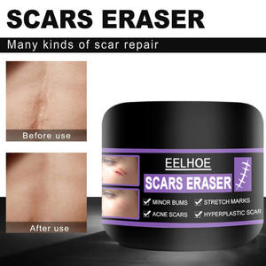 Crème de nuit à base de plantes éclaircissante, traitement des marques, des boutons, des cicatrices, élimination du mélasma, crème <span class=keywords><strong>anti</strong></span>-acné pour le visage, 30g - Product Image 4