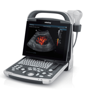 Sistema <span class=keywords><strong>de</strong></span> Diagnóstico por <span class=keywords><strong>Ultrasonido</strong></span> Doppler Color Digital Portátil Mindray DP-30 con Imágenes <span class=keywords><strong>de</strong></span> Alta Resolución para Uso Clínico - Product Image 4