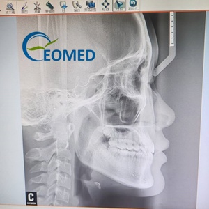 Système de radiographie céphalométrique numérique d'occasion robuste à numérisation rapide pour diagnostic panoramique oral en milieu hospitalier dentaire - Product Image 3
