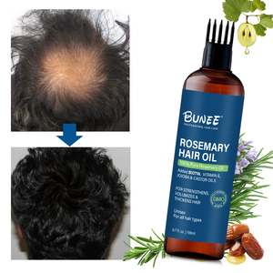 Private Label Natural Anti Loss Nou rishing Unisex Kräuter serum Behandlung Glatze Haarausfall Vitamin Fast <span class=keywords><strong>Hair</strong></span> Growth Oil Spray