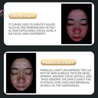 Nouveau Analyseur de Peau X5-AI 2026 – Détecteur Facial 11 Spectres avec IA pour l'Âge, l'Acné et les Pigments – Appareil de Salon à Écran Tactile