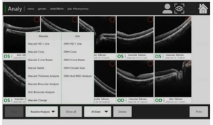 OCT-500 peralatan diagnostik pencitraan <span class=keywords><strong>Retinal</strong></span> presisi tinggi, pemindai tomografi moderen optik oftalik dengan garansi 1 tahun - Product Image 6