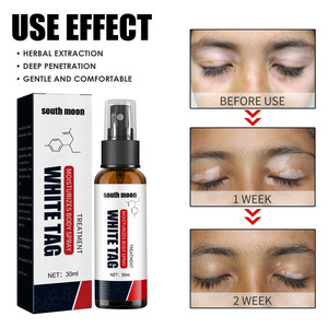 Nouveau Spray Traitant le Vitiligo à Base d'Extraits Végétaux – Répare et Élimine les <span class=keywords><strong>Taches</strong></span> <span class=keywords><strong>Blanches</strong></span> - Product Image 5