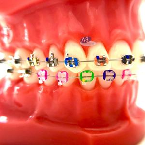Materiali di consumo dentali filo <span class=keywords><strong>NiTi</strong></span> in metallo ortodontico con forma ovoidale - Product Image 6