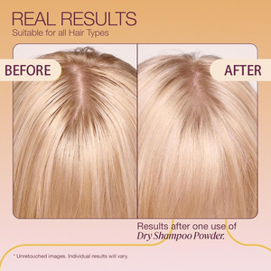 Champú seco sin lavado de etiqueta privada, elimina el desenredado y el aceite, da <span class=keywords><strong>brillo</strong></span> <span class=keywords><strong>al</strong></span> <span class=keywords><strong>cabello</strong></span> en polvo, spray <span class=keywords><strong>para</strong></span> peinar el <span class=keywords><strong>cabello</strong></span>, champú seco - Product Image 5
