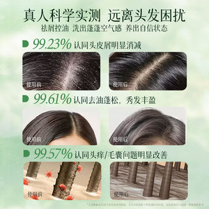 Champú y Acondicionador con Aminoácidos Starry Window 550g para Cabello Seco con Aroma a Té Blanco Anticaspa y Voluminizador - Product Image 2