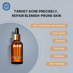 Sérum Anti-Acné 100% Pur et Naturel à Marque Blanche en Gros – Contrôle du Sébum, Éclaircissement des Marques d'Acné, Réparation de la Barrière Cutanée à l'Acide Salicylique - Product Image 3