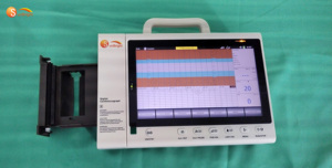 Monitor Fetal Portátil para Hospital, Máquina de Monitoreo Cardíaco del Bebé (<span class=keywords><strong>CTG</strong></span>) para Embarazo - Product Image 4