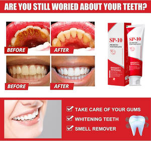ยาสีฟันฟอกสีฟัน SP-10 สูตรโปรไบโอติก ลดคราบเหลืองบนฟัน ลมหายใจหอมสดชื่น ดูแลช่องปาก กลิ่นมิ้นท์ 120 กรัม - Product Image 3