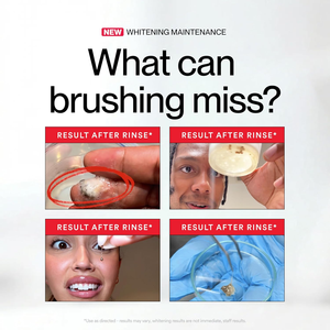 Huiles Essentielles 2026 pour une Haleine Fraîche – Bouteille Taille Standard – Bain de Bouche Nettoyant et Blanchissant pour les Taches et les Impuretés (237ml) - Product Image 4